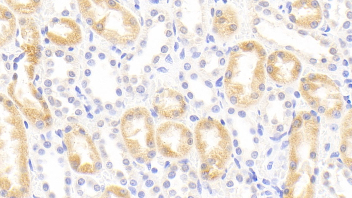 Monoclonal Antibody to Interleukin 18 (IL18)