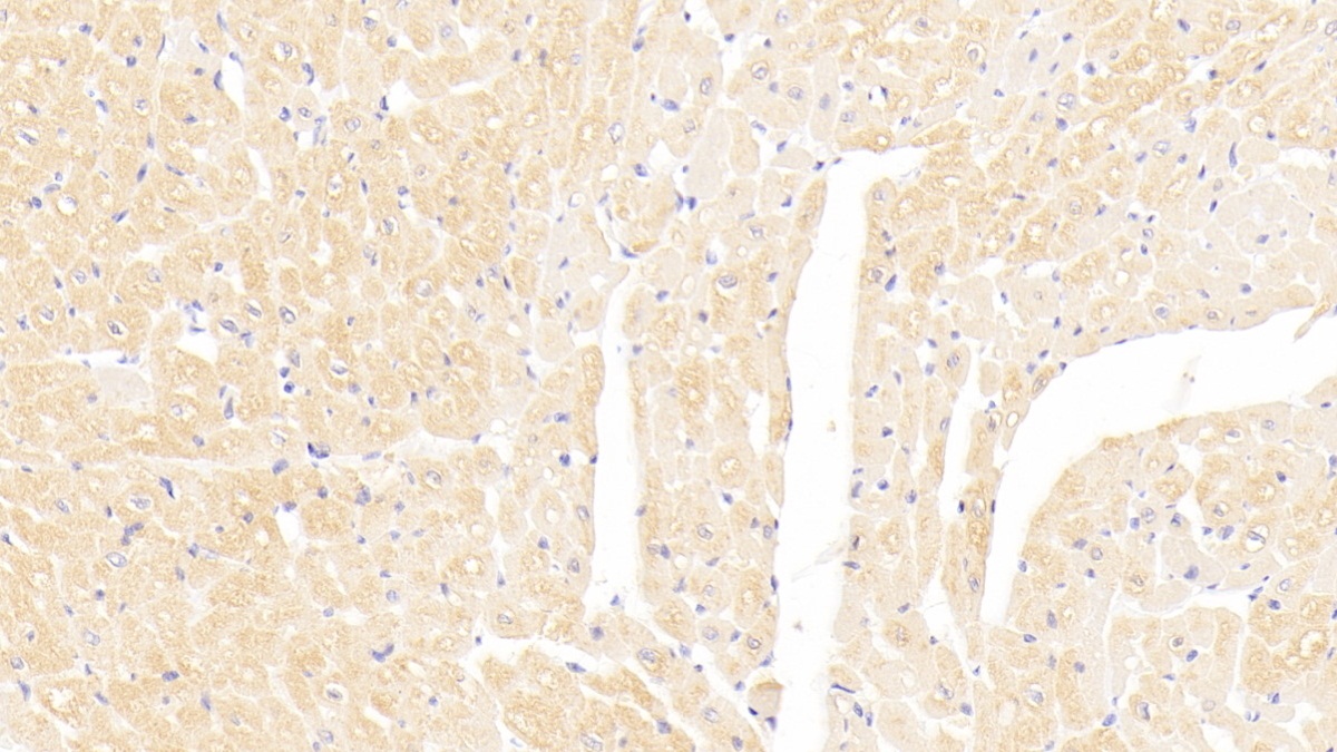 Monoclonal Antibody to Interleukin 18 (IL18)