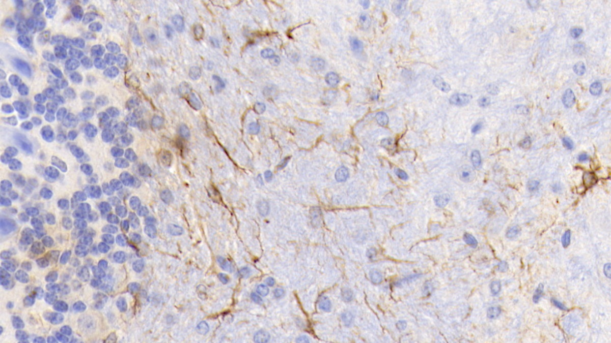 Monoclonal Antibody to Glial Fibrillary Acidic Protein (GFAP)