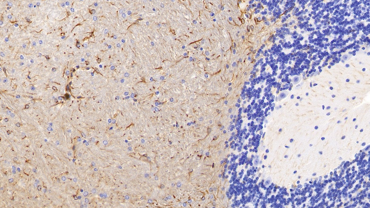 Monoclonal Antibody to Glial Fibrillary Acidic Protein (GFAP)