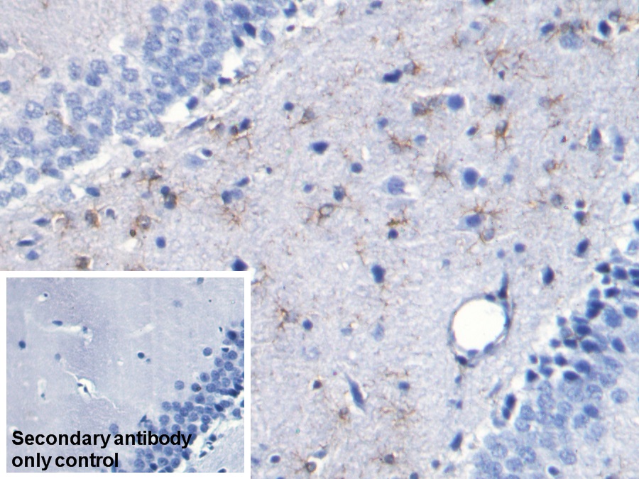 Monoclonal Antibody to Glial Fibrillary Acidic Protein (GFAP)