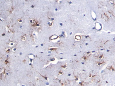 Monoclonal Antibody to Glial Fibrillary Acidic Protein (GFAP)