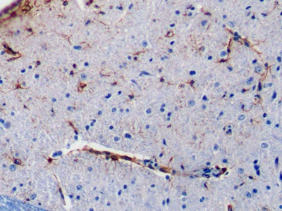 Monoclonal Antibody to Glial Fibrillary Acidic Protein (GFAP)