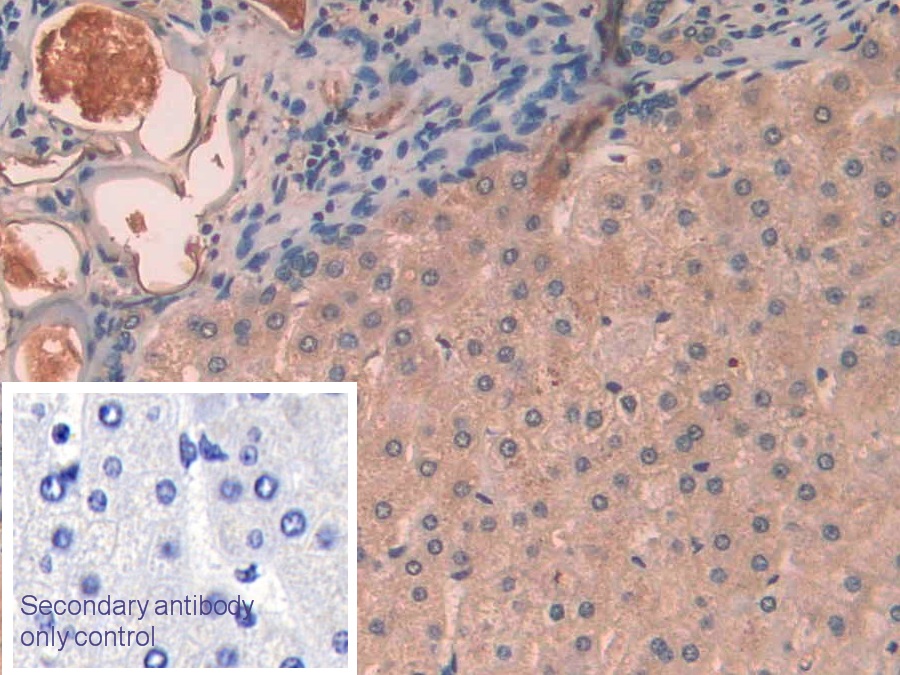 Monoclonal Antibody to Interleukin 1 Alpha (IL1a)