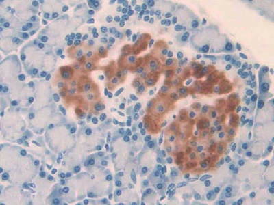 Monoclonal Antibody to Interleukin 1 Alpha (IL1a)