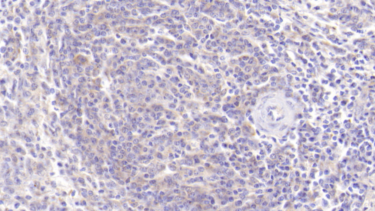 Monoclonal Antibody to Interleukin 2 (IL2)