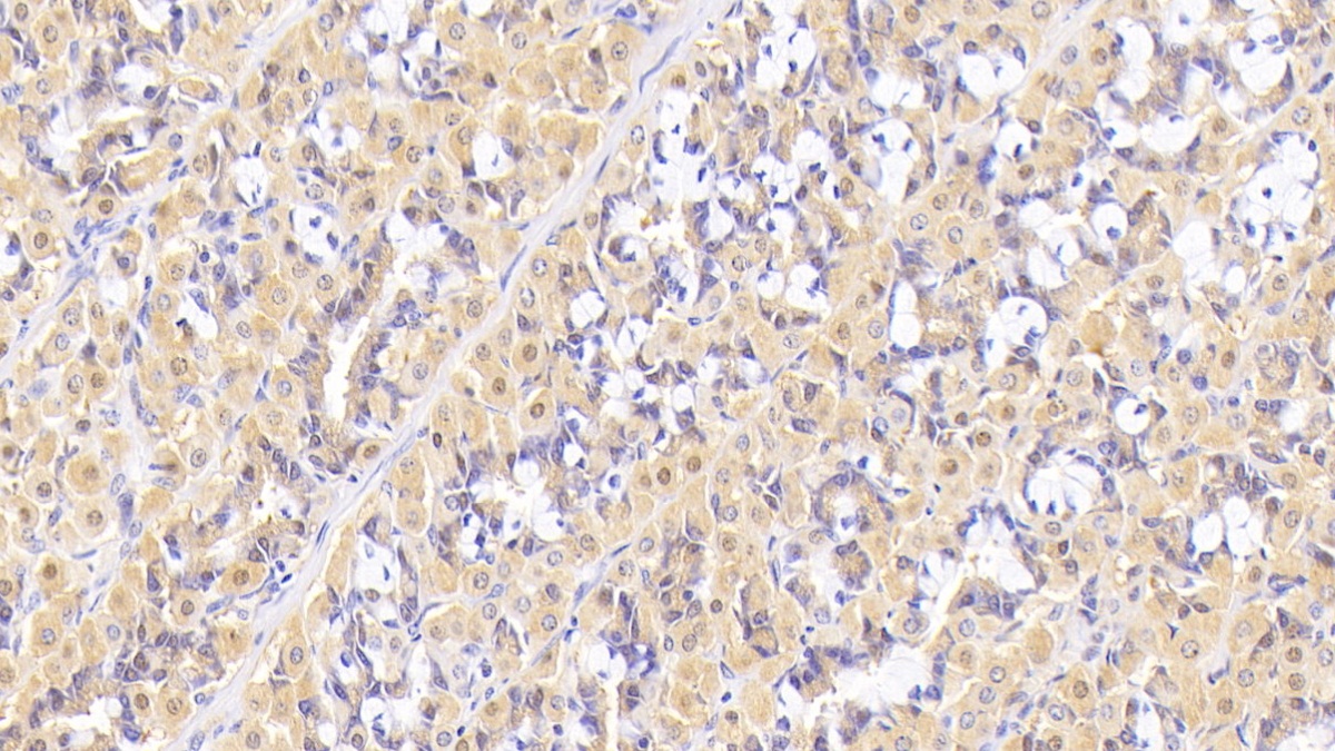 Monoclonal Antibody to Interleukin 5 (IL5)