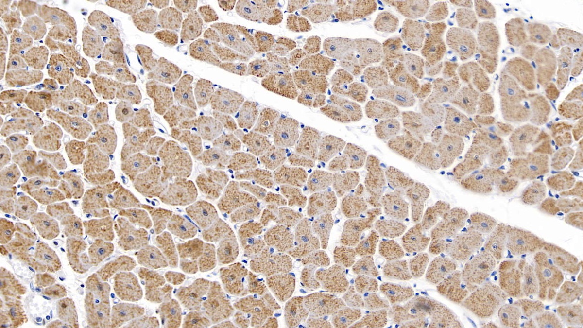 Monoclonal Antibody to Interleukin 6 (IL6)