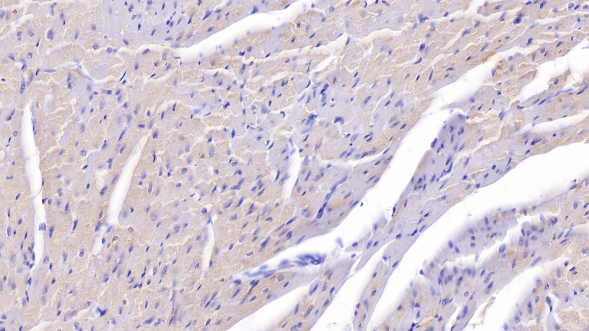 Monoclonal Antibody to Interleukin 6 (IL6)