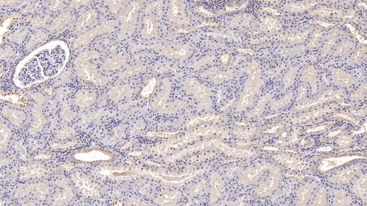 Monoclonal Antibody to Interleukin 9 (IL9)