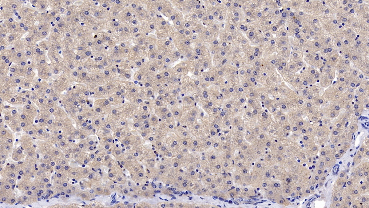 Monoclonal Antibody to Leptin (LEP)