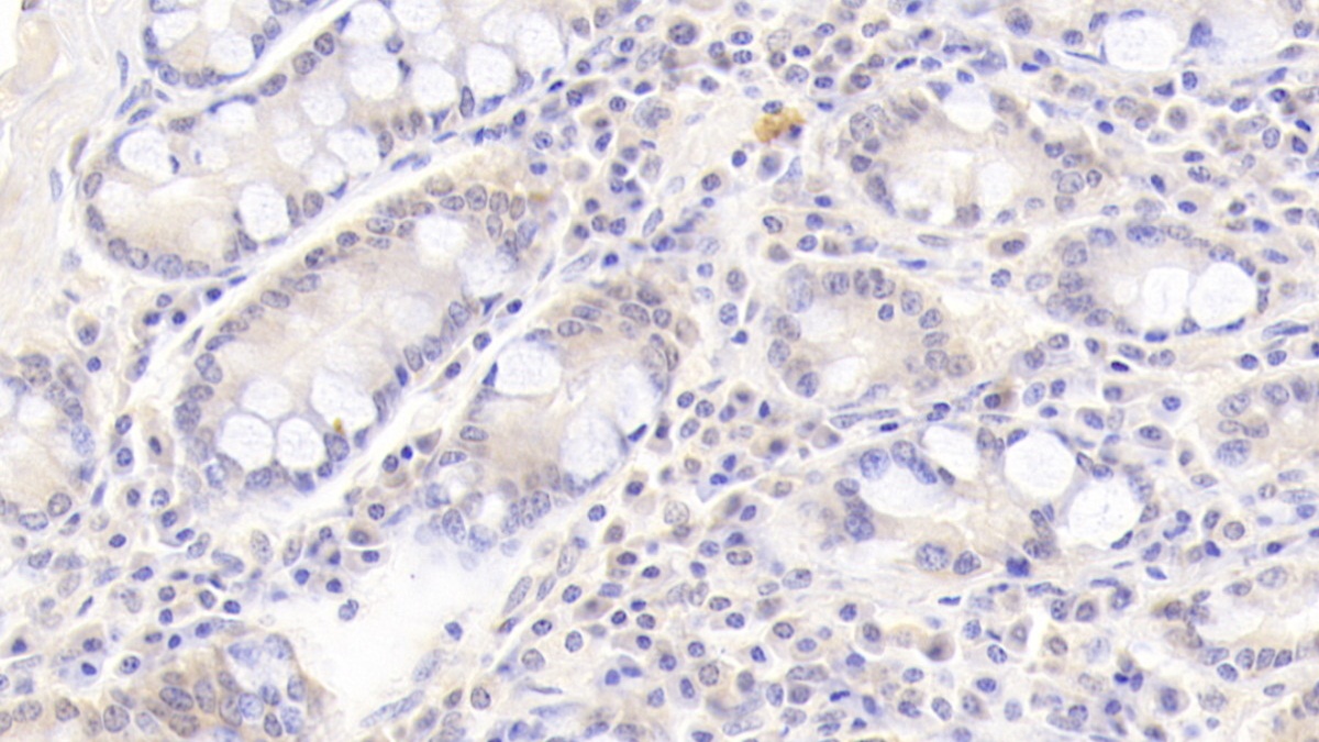 Monoclonal Antibody to Leukemia Inhibitory Factor (LIF)