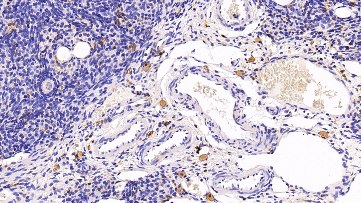 Monoclonal Antibody to Macrophage Inflammatory Protein 1 Alpha (MIP1a)