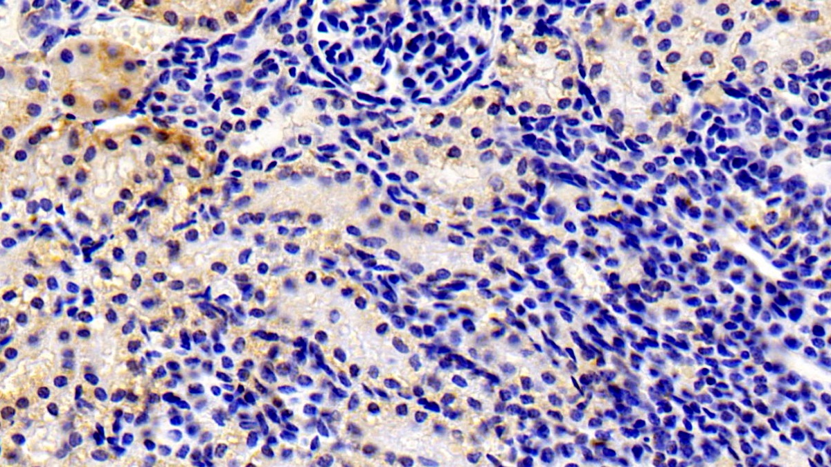 Monoclonal Antibody to Matrix Metalloproteinase 13 (MMP13)