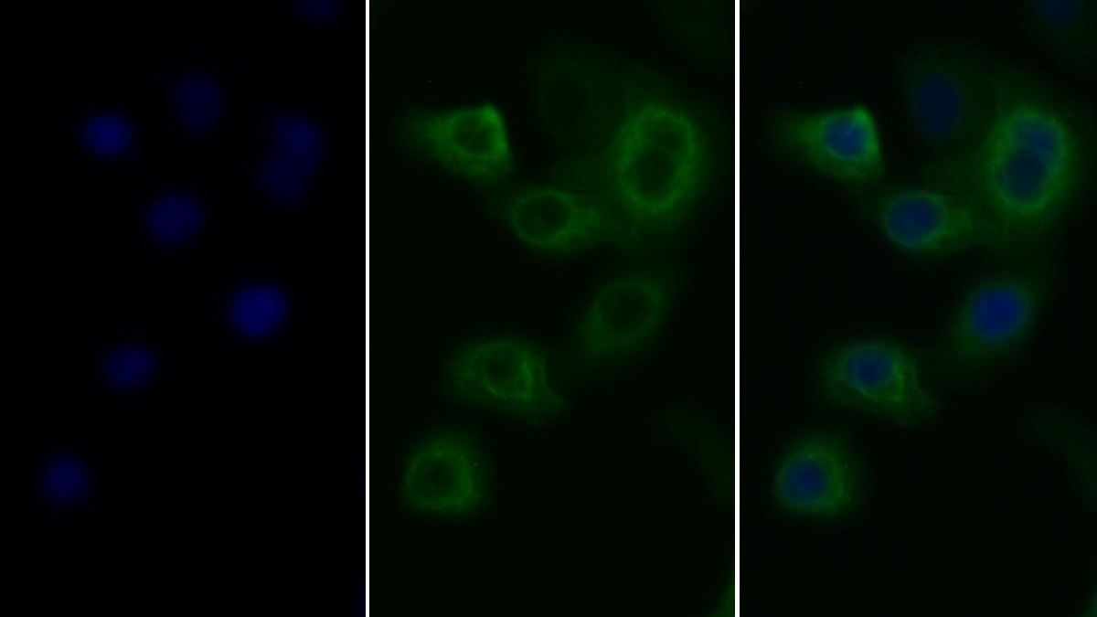 Monoclonal Antibody to Matrix Metalloproteinase 2 (MMP2)