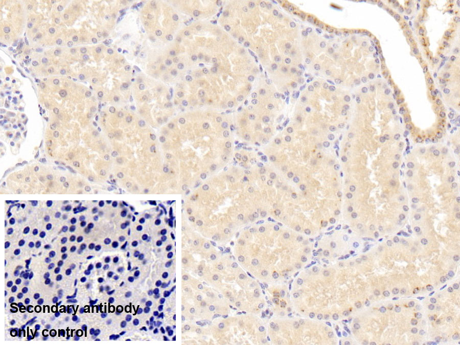 Monoclonal Antibody to Matrix Metalloproteinase 7 (MMP7)