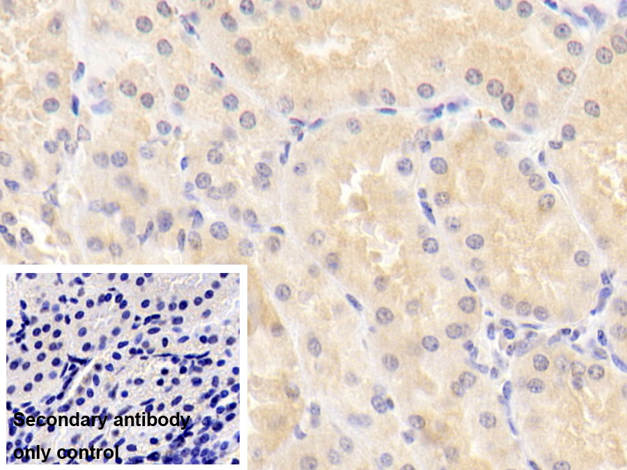 Monoclonal Antibody to Matrix Metalloproteinase 7 (MMP7)