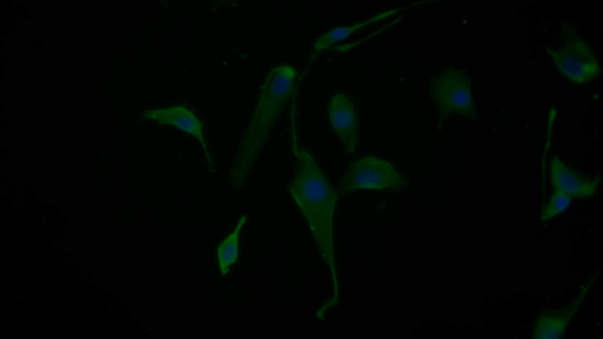 Monoclonal Antibody to Nerve Growth Factor (NGF)