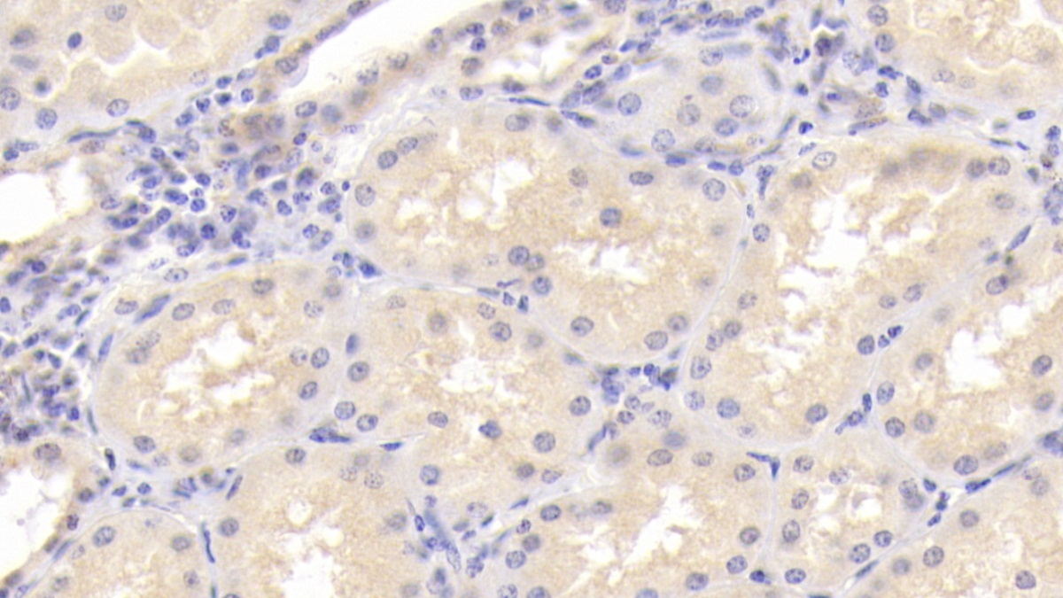 Monoclonal Antibody to Osteoprotegerin (OPG)