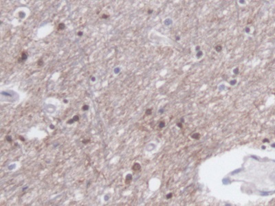 Monoclonal Antibody to Creatine Kinase, Muscle (CKM)