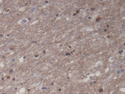 Monoclonal Antibody to Creatine Kinase, Muscle (CKM)