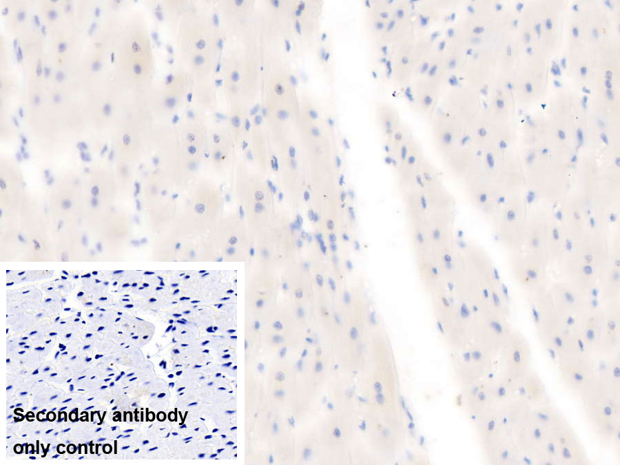 Monoclonal Antibody to Cluster Of Differentiation 40 Ligand (CD40L)