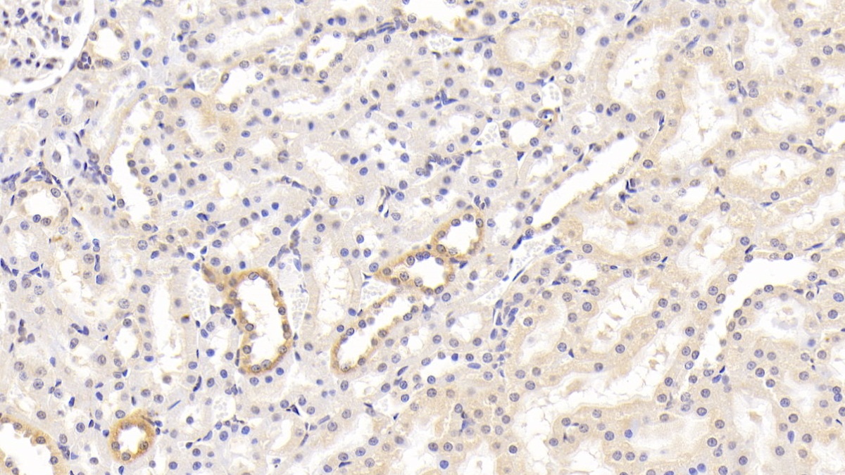 Monoclonal Antibody to Cluster Of Differentiation 40 Ligand (CD40L)