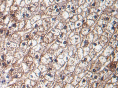 Monoclonal Antibody to Transforming Growth Factor Beta 1 (TGFb1)