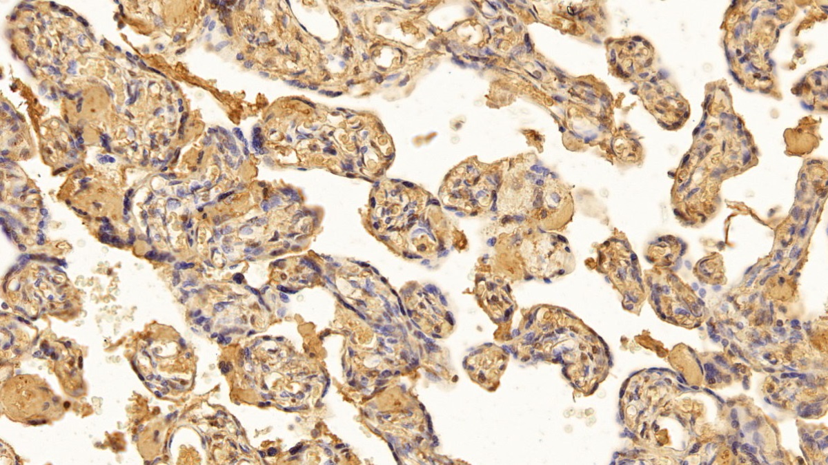 Monoclonal Antibody to Transforming Growth Factor Beta 1 (TGFb1)