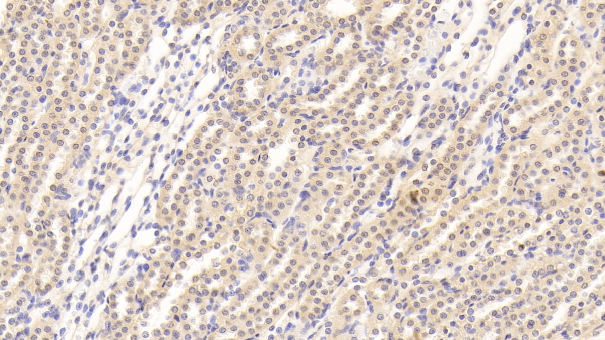 Monoclonal Antibody to Transforming Growth Factor Beta 1 (TGFb1)