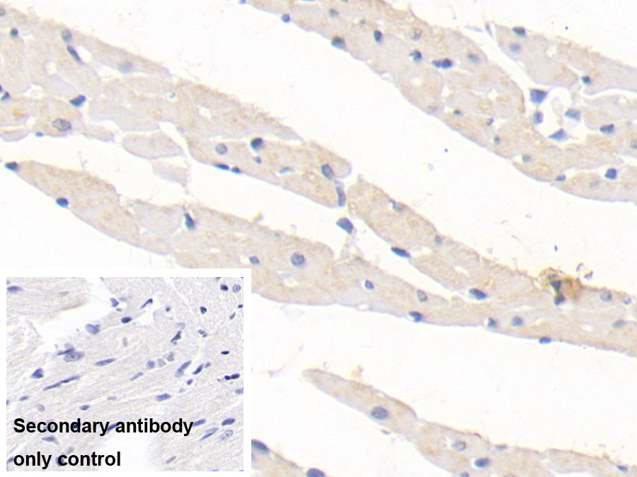 Monoclonal Antibody to Transforming Growth Factor Beta 1 (TGFb1)