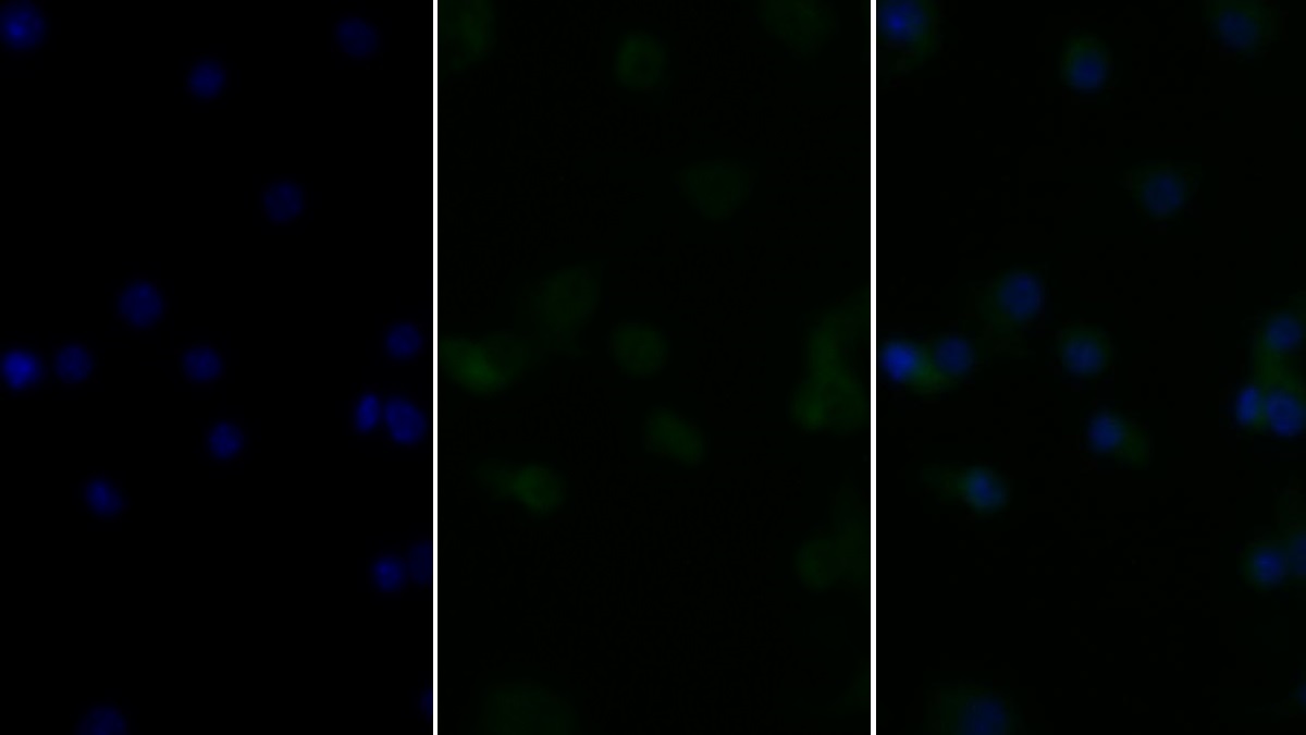 Monoclonal Antibody to Tumor Necrosis Factor Alpha (TNFa)