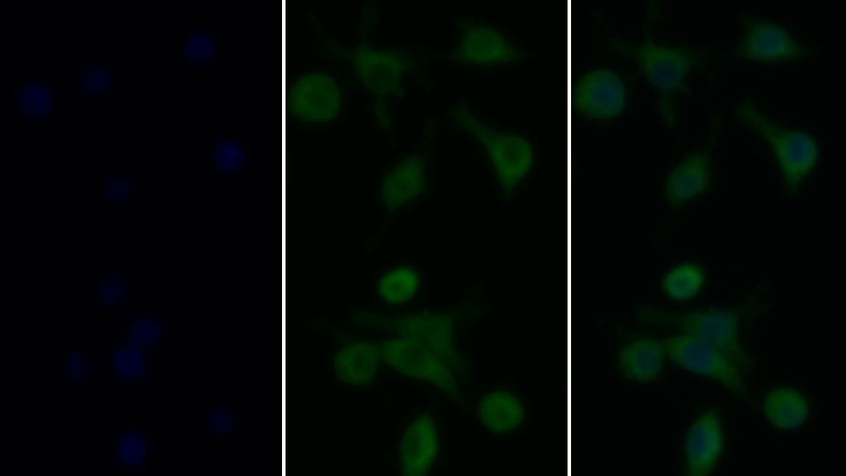 Monoclonal Antibody to Tumor Necrosis Factor Alpha (TNFa)