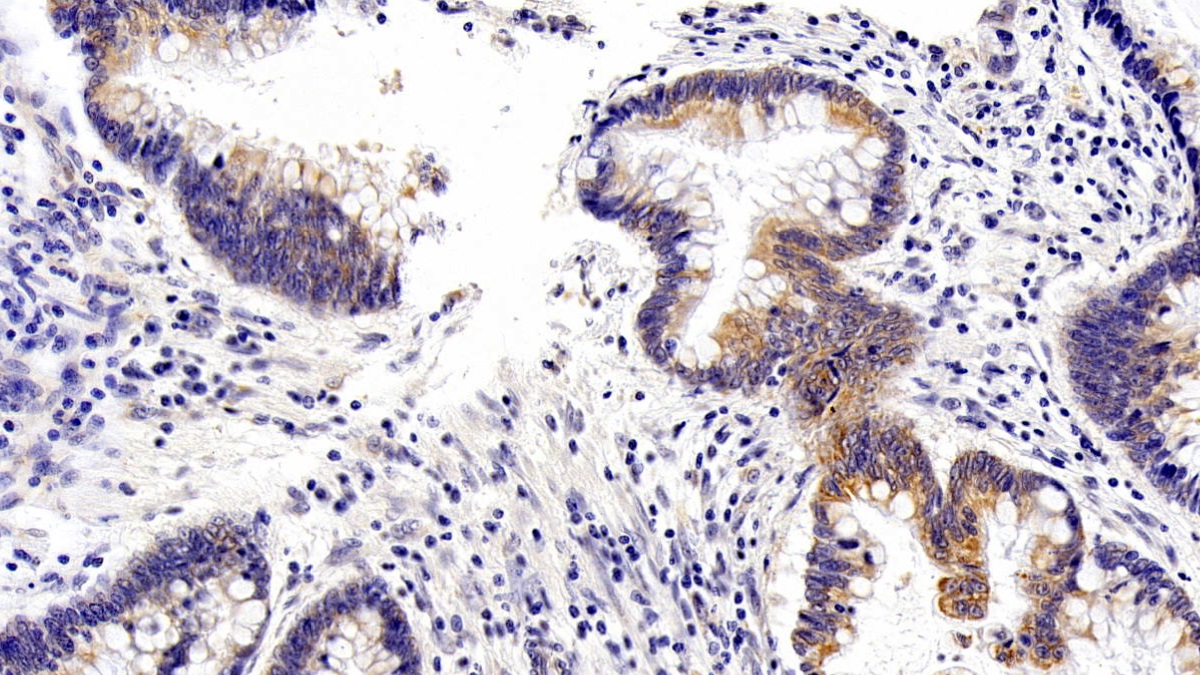 Monoclonal Antibody to Vascular Endothelial Growth Factor C (VEGFC)