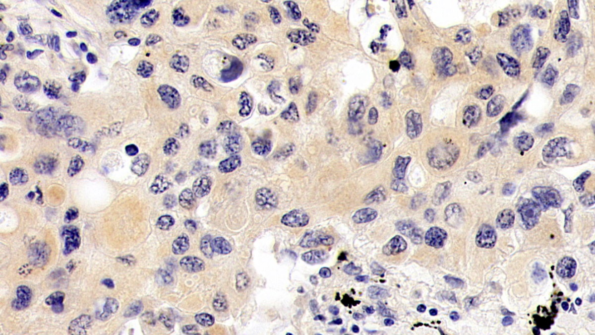 Monoclonal Antibody to Vascular Endothelial Growth Factor C (VEGFC)