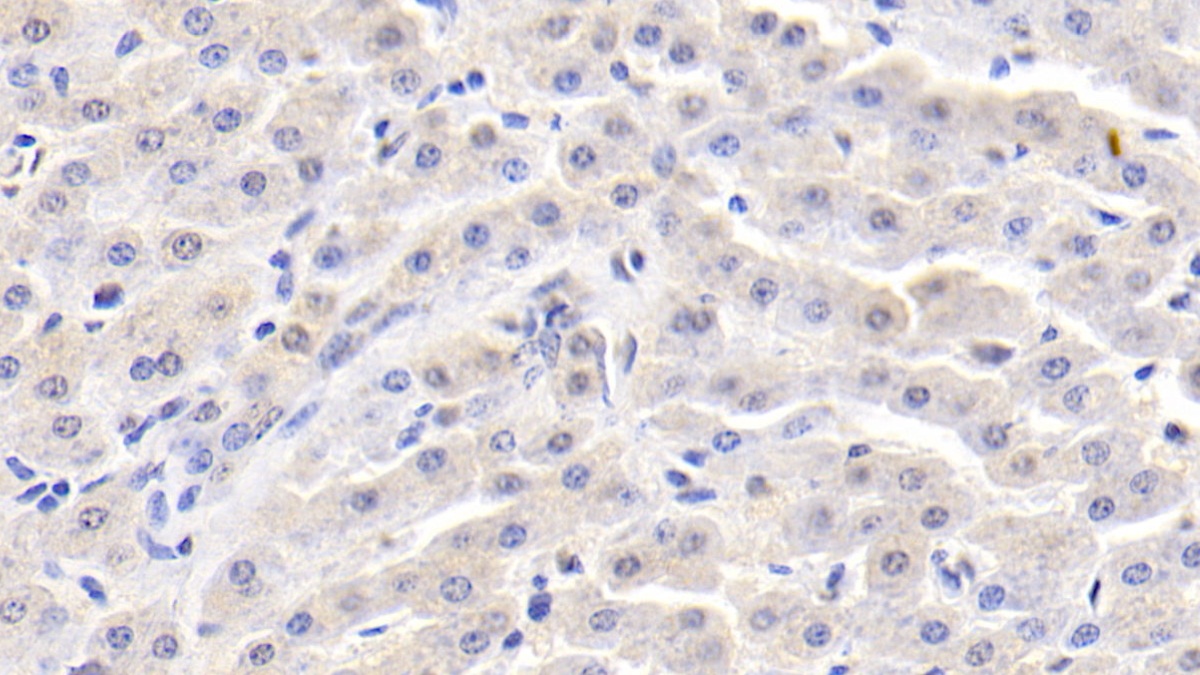 Monoclonal Antibody to Alpha-Fetoprotein (AFP)