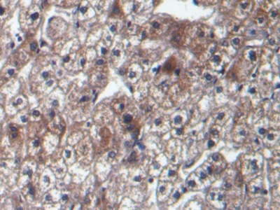 Monoclonal Antibody to Alpha-Fetoprotein (AFP)