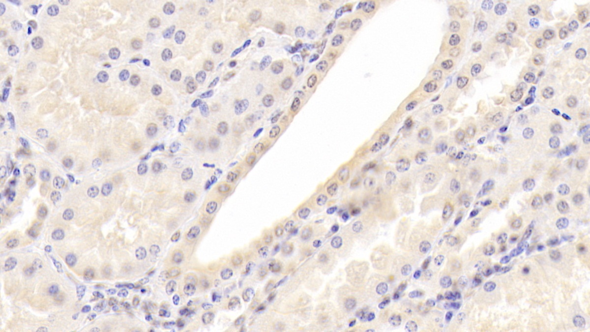 Monoclonal Antibody to Alpha 2-Antiplasmin (a2PI)