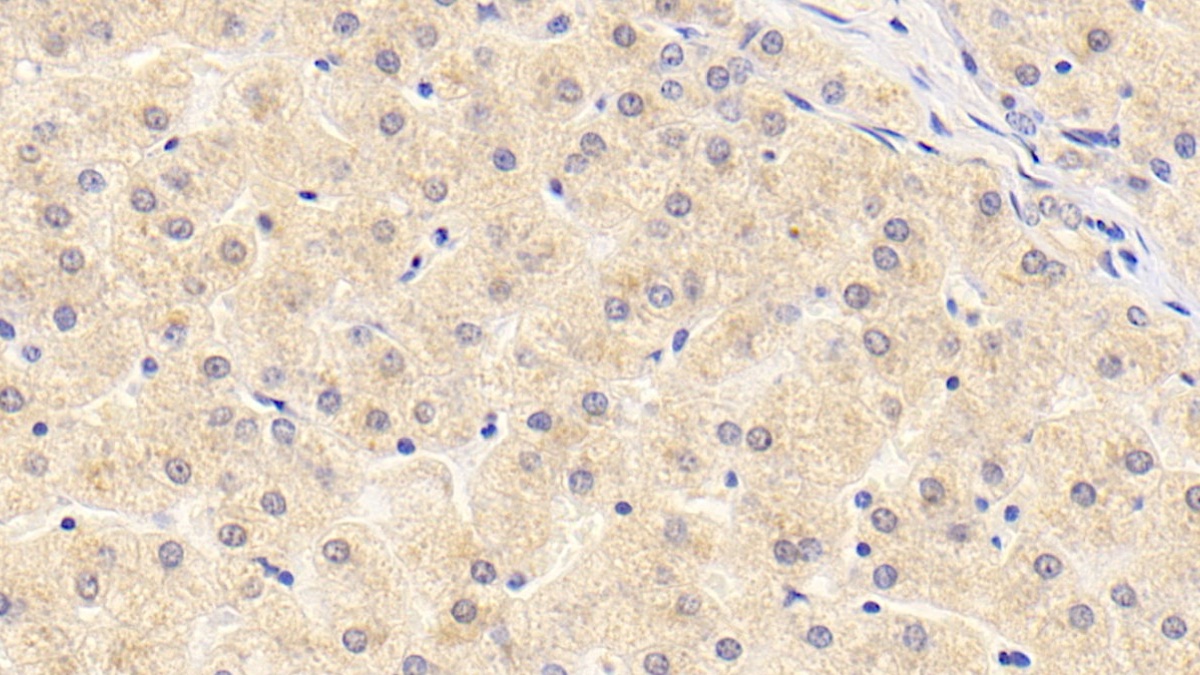 Monoclonal Antibody to Alpha 2-Antiplasmin (a2PI)