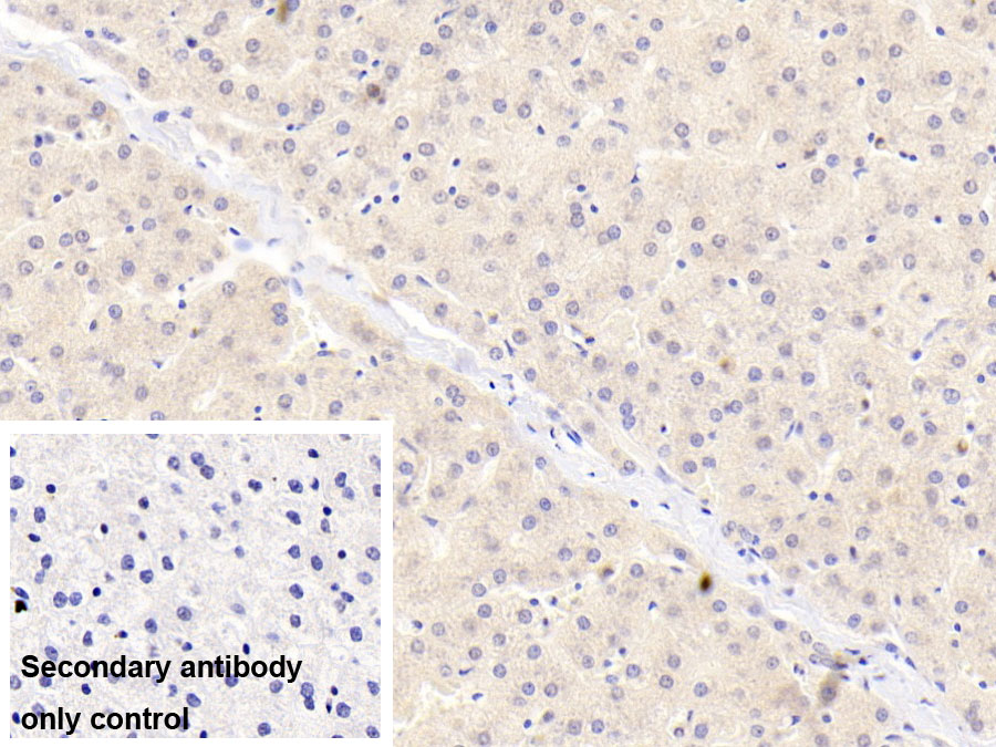 Monoclonal Antibody to Alpha 2-Antiplasmin (a2PI)