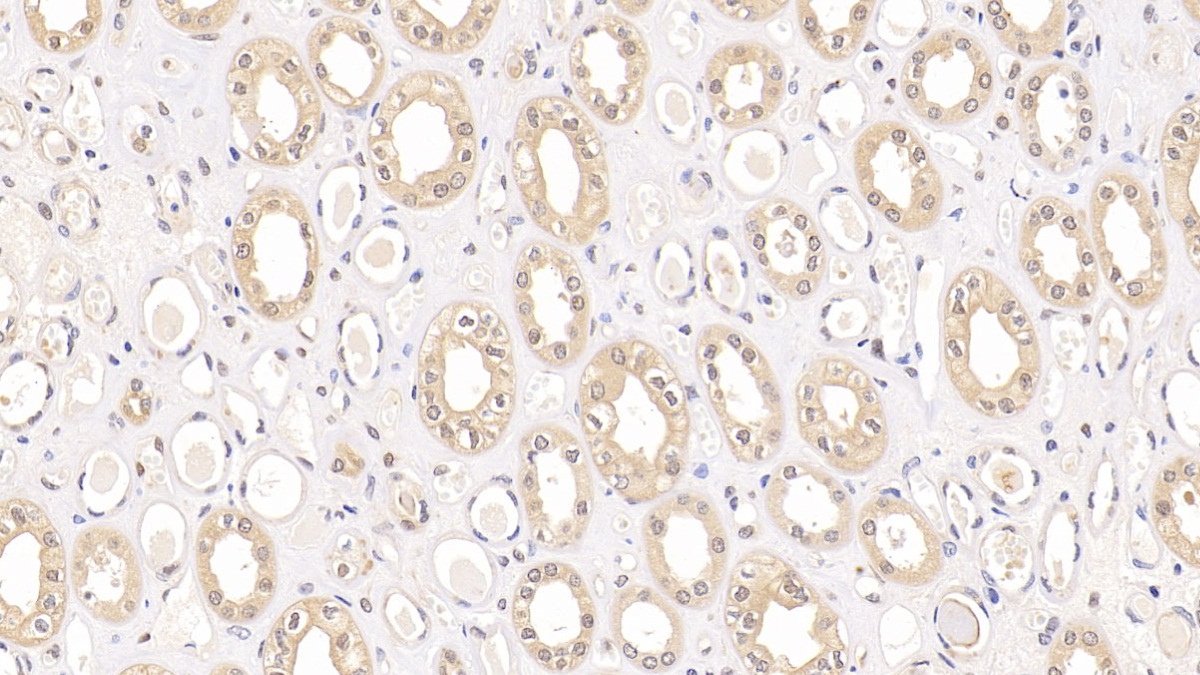 Monoclonal Antibody to Ubiquitin (Ub)