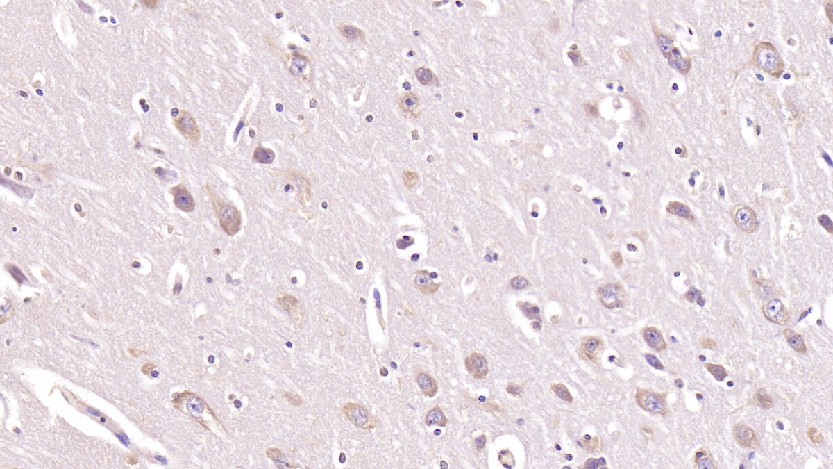 Monoclonal Antibody to Ubiquitin (Ub)