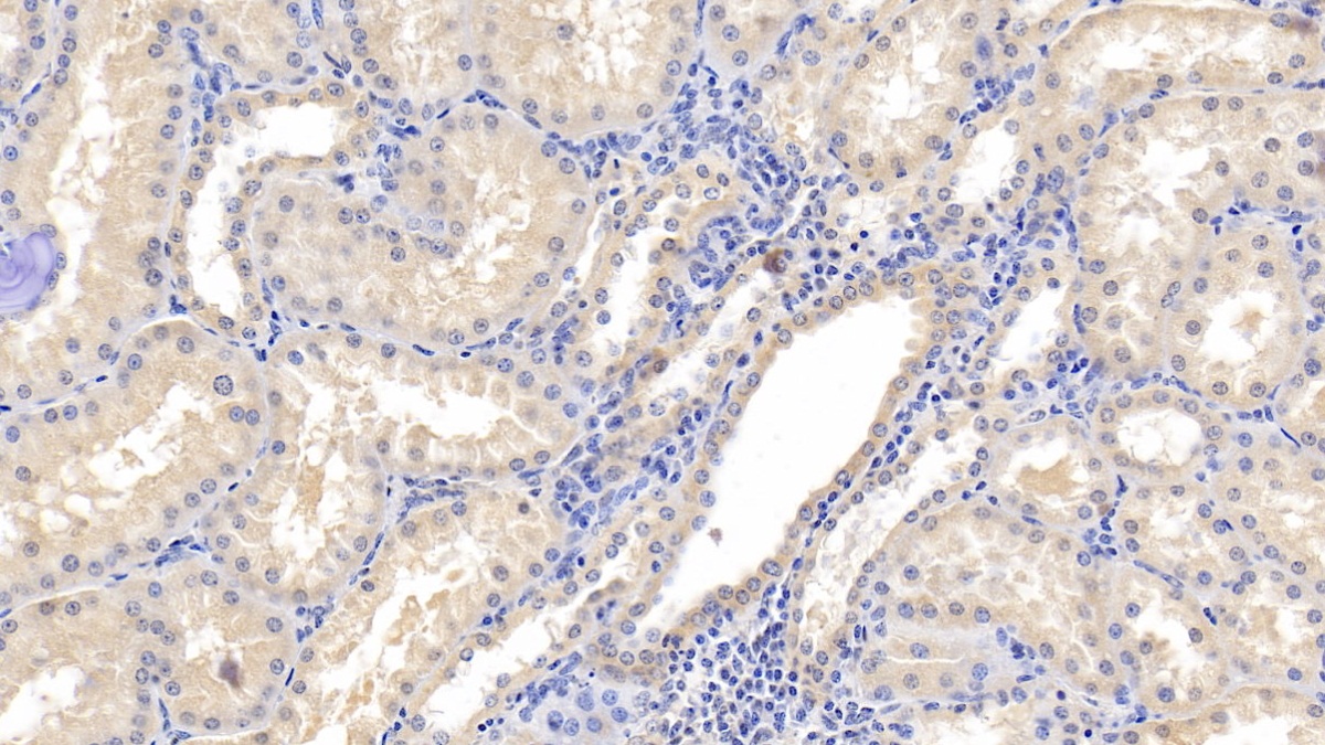 Monoclonal Antibody to Ubiquitin (Ub)