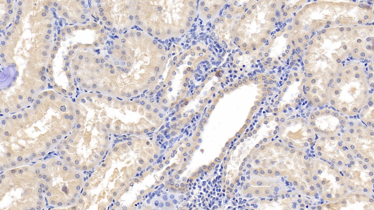 Monoclonal Antibody to Ubiquitin (Ub)