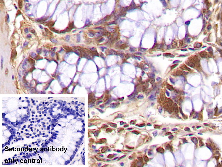 Monoclonal Antibody to Ubiquitin (Ub)