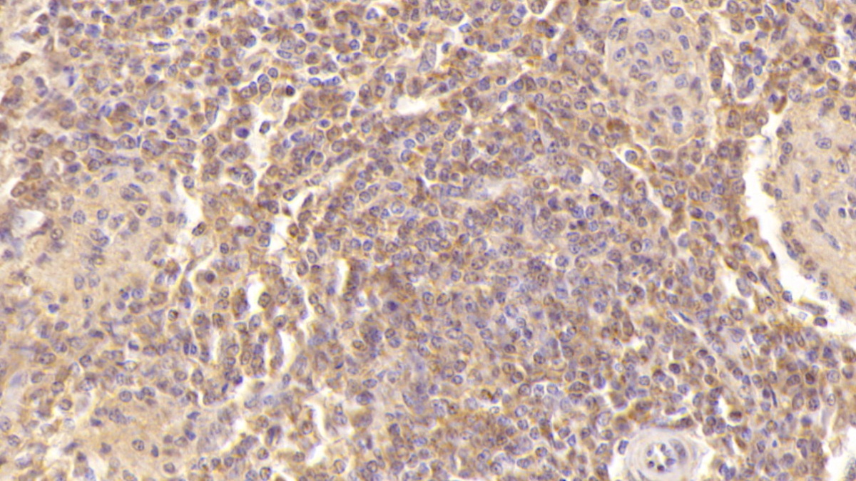 Monoclonal Antibody to Platelet Factor 4 (PF4)