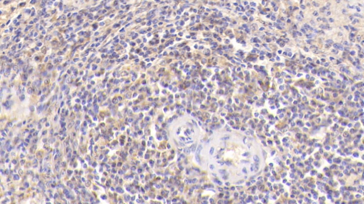 Monoclonal Antibody to Platelet Factor 4 (PF4)