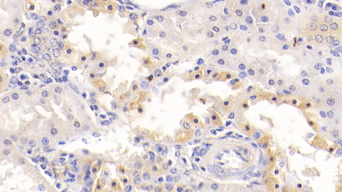 Monoclonal Antibody to Alanine Aminotransferase (ALT)