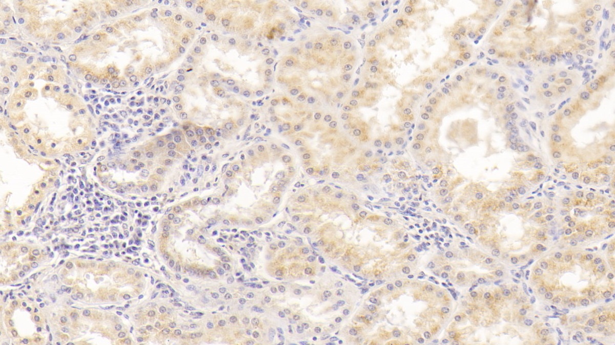 Monoclonal Antibody to Alanine Aminotransferase (ALT)