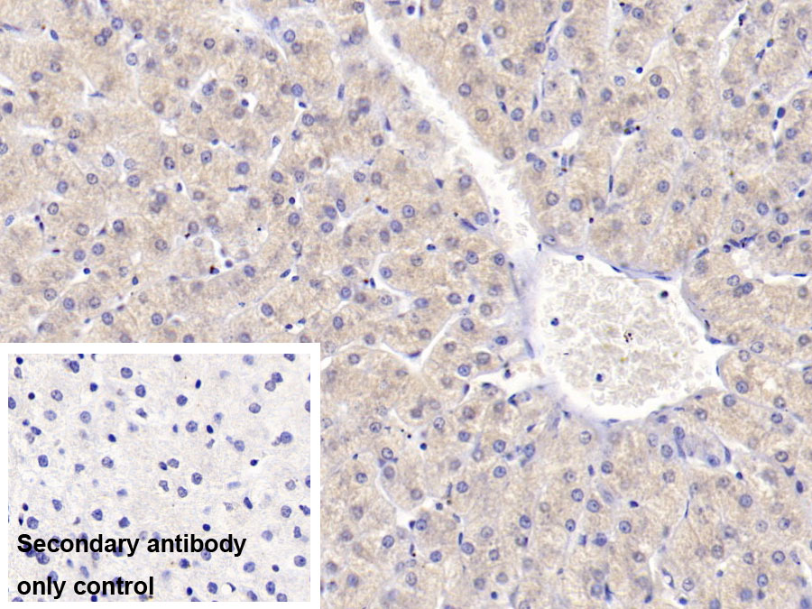 Monoclonal Antibody to Alanine Aminotransferase (ALT)